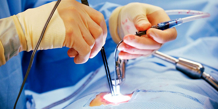 Laser Treatment