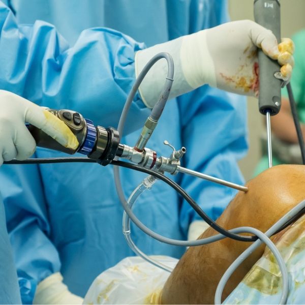 Rotator Cuff Tear Surgery