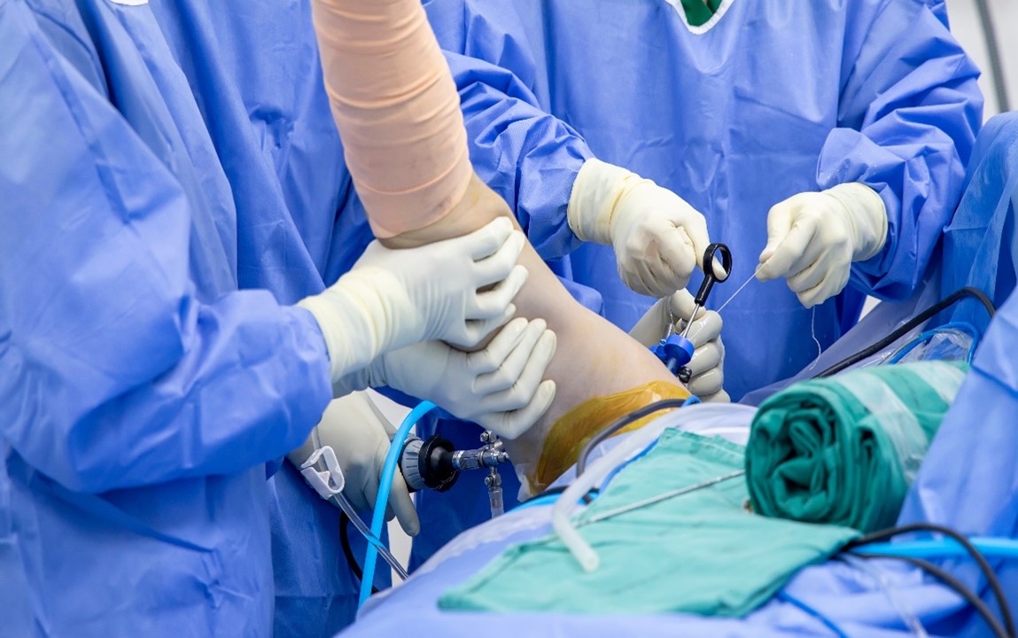 Shoulder Arthroscopy Surgery