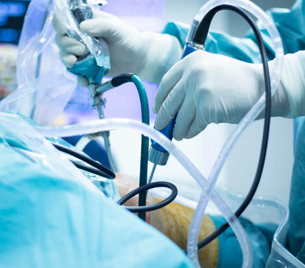 Top 05 Best Arthroscopy Surgeon in Surat